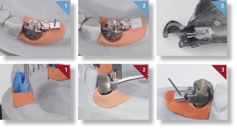 Working Procedures for DUPLI attachments