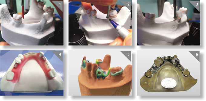 Working Procedures for FOX attachments